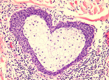 histo_t_beer_histopathology_785x400.jpg