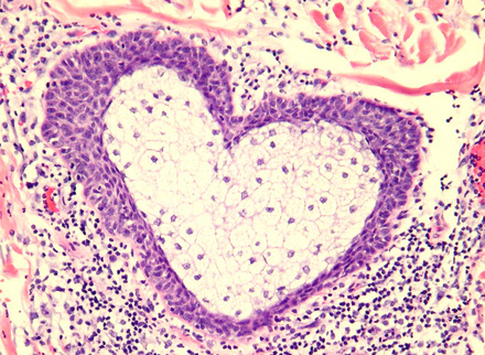 histo_t_beer_histopathology_785x400.jpg