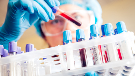 Scientist holding blood tube sample