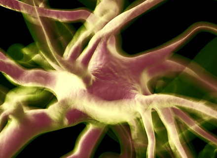 neuron_neurohistopathology_neuropathology_41095407_785x400px.jpg