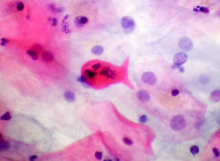 cyto_h_cochrane_histopathology_&_cytopathology_785x400.jpg