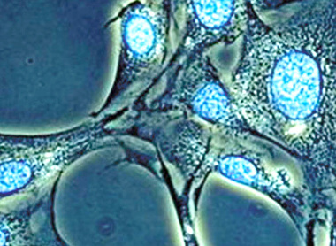 fluorescencefig4_cytopathology_785x400.jpg